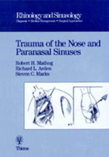 Trauma of the Nose and Paranasal Sinuses (Rhinology & Sinusology S.) Medicine