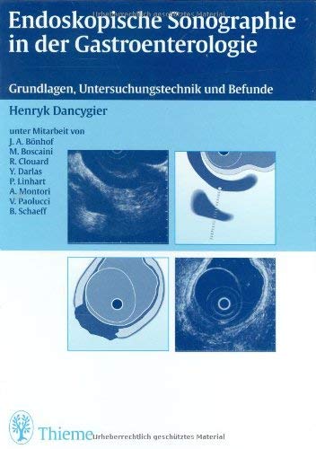 Endoskopische Sonographie in der Gastroenterologie: Grundlagen, Untersuchungstechnik und Befunde Medicine