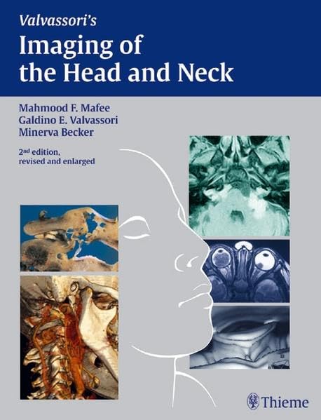 Imaging of the Head and Neck Medicine