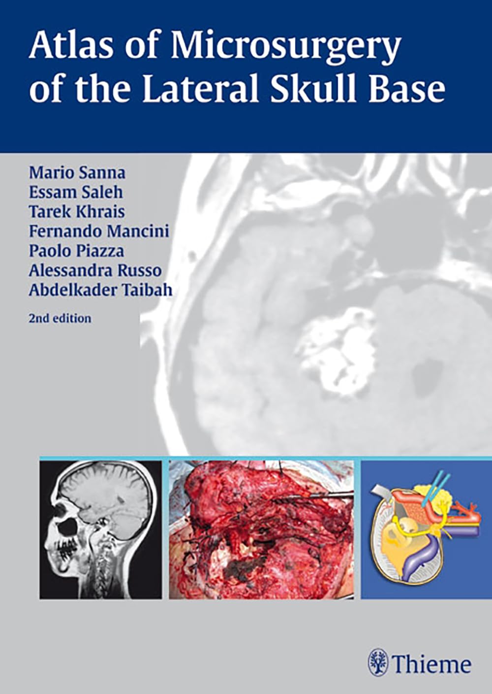 Atlas of Microsurgery of the Lateral Skull Base Medicine