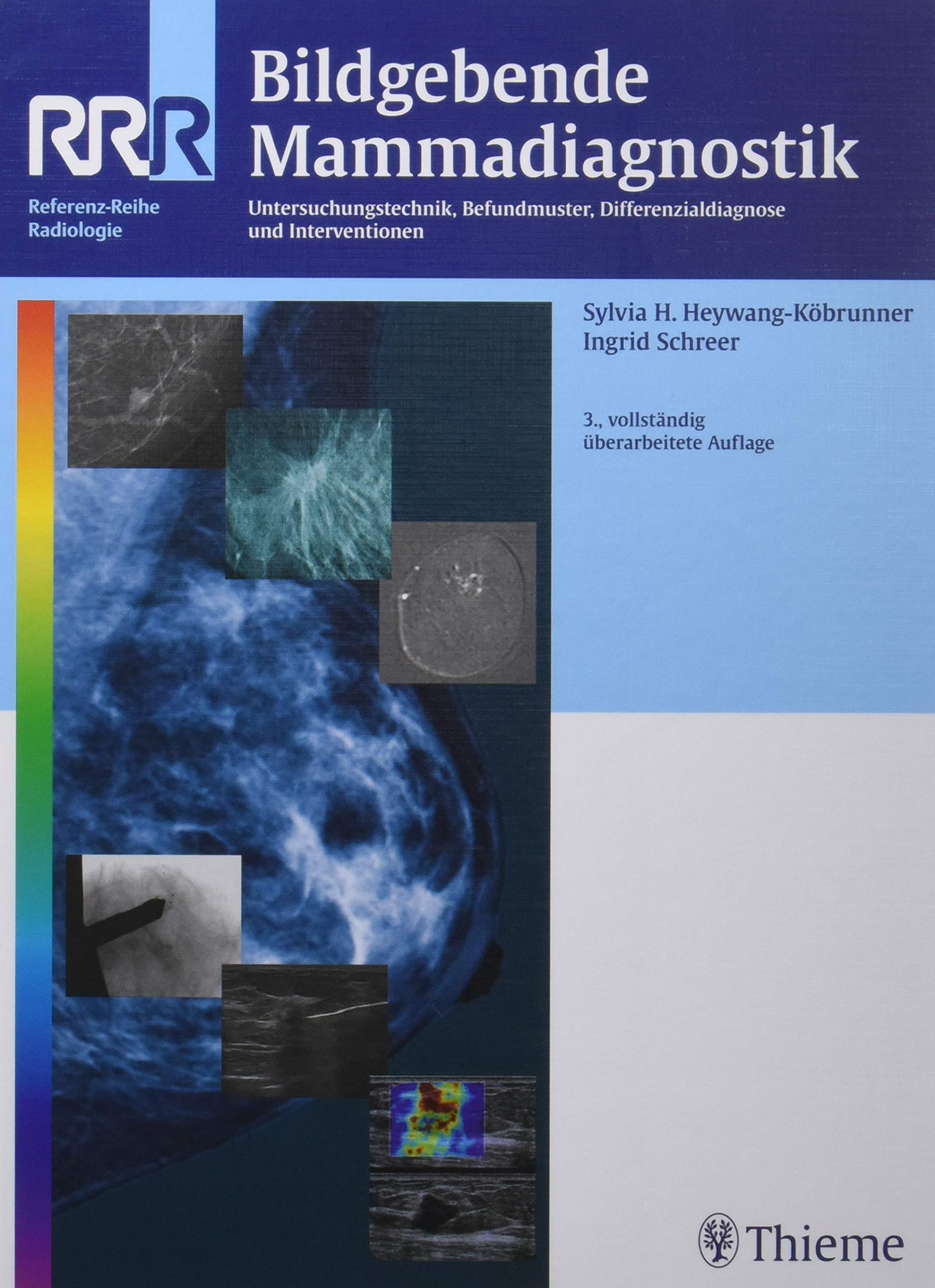Bildgebende Mammadiagnostik: Untersuchungstechnik, Befundmuster, Differenzialdiagnose und Intervention book
