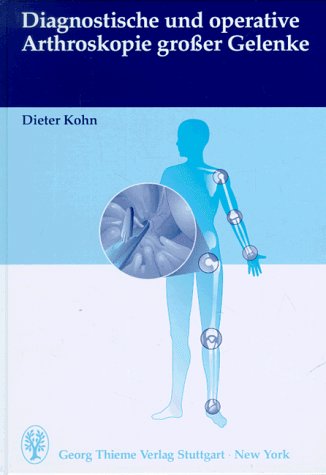 Diagnostische und operative Arthroskopie grosser Gelenke Medicine
