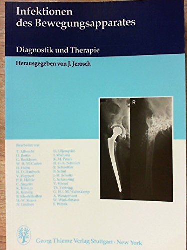 Infektionen des Bewegungsapparates Medicine
