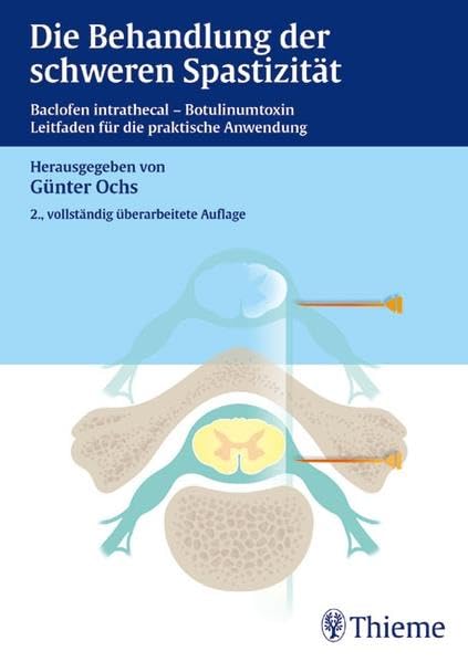 Die Behandlung der schweren Spastizität: Baclofen intrathecal - Botulinumtoxin Leitfaden für die praktische Anwendung Medicine