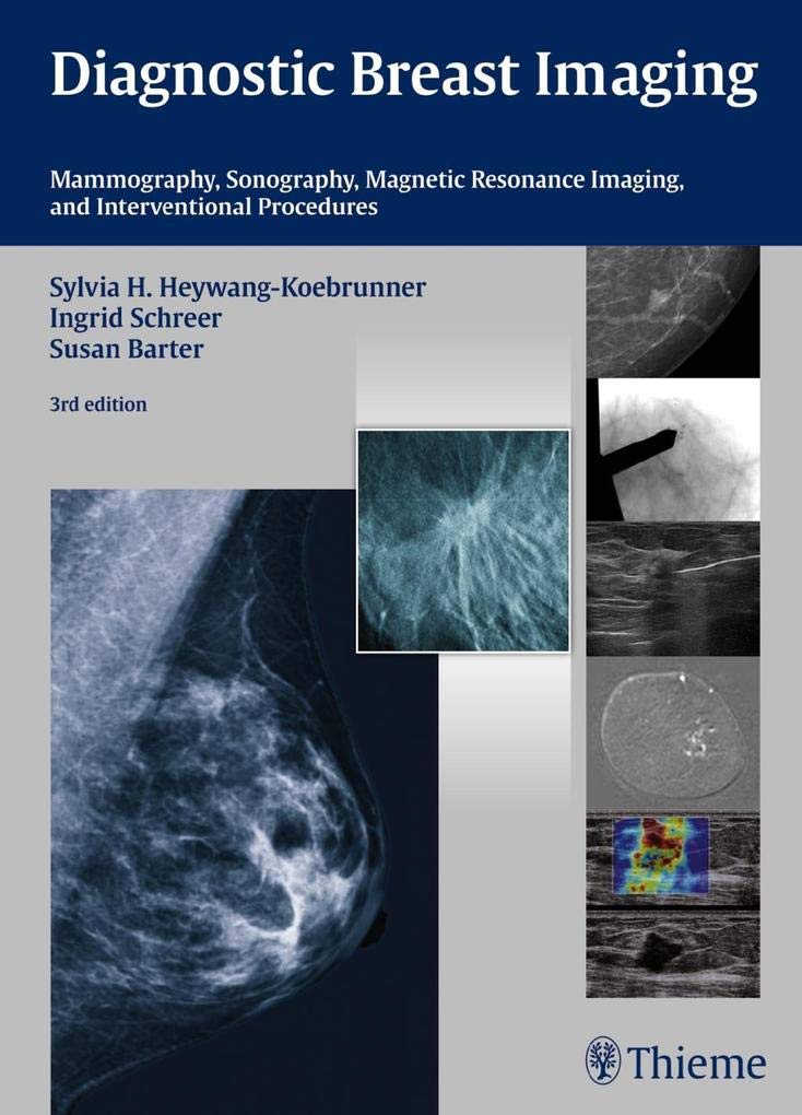 Diagnostic Breast Imaging: Mammography, Sonography, MRI and Interventional Procedures: Mammography, Sonography, Magnetic Resonance Imaging and Interventional Procedures Medicine