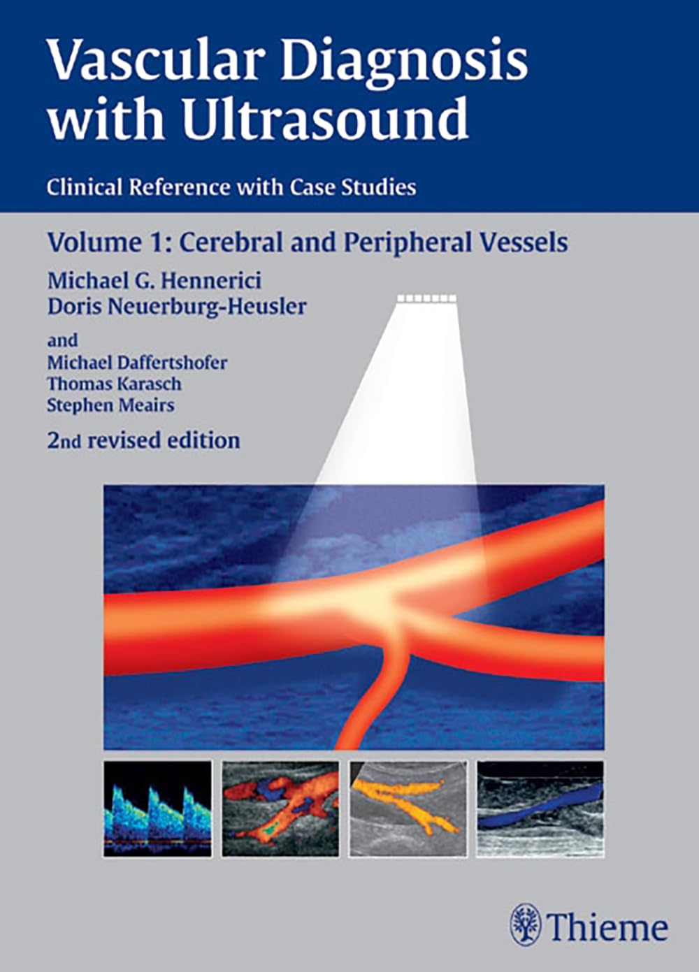 Vascular Diagnosis with Ultrasound: Clinical Reference with Case Studies Volume 1: Cerebral and Peripheral Vessels Medicine