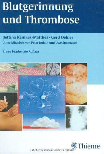Blutgerinnung und Thrombose Medicine