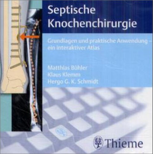 Septische Knochenchirurgie, 1 CD-ROM Grundlagen und praktische Anwendung, ein interaktiver Atlas. Für Windows 95/98/NT 4.0 cd