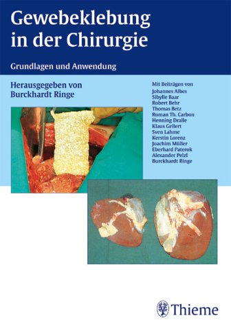 Gewebeklebung in der Chirurgie. Grundlagen und Anwendung Medicine