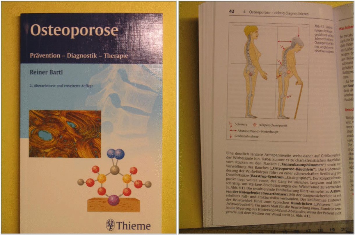 Osteoporose: Prävention - Diagnostik - Therapie Medicine