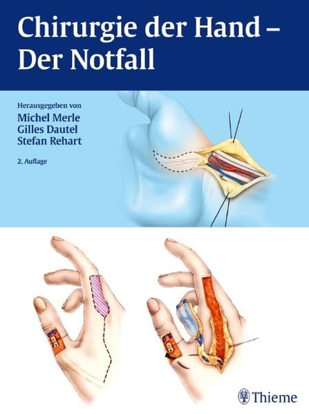 Chirurgie der Hand: Der Notfall Medicine