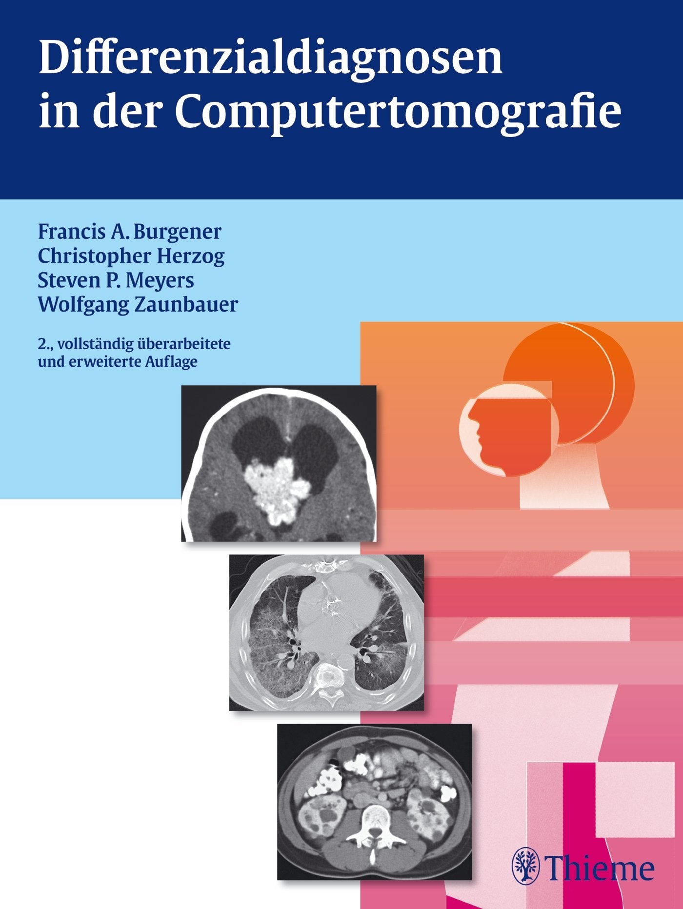 Differenzialdiagnosen in der Computertomografie Medicine