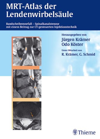 MR-Atlas der Lendenwirbelsäule. Bandscheibenvorfall - Spinalkanalstenose. Mit einem Beitrag zur CT-gesteuerten Injektionstechnik Medicine