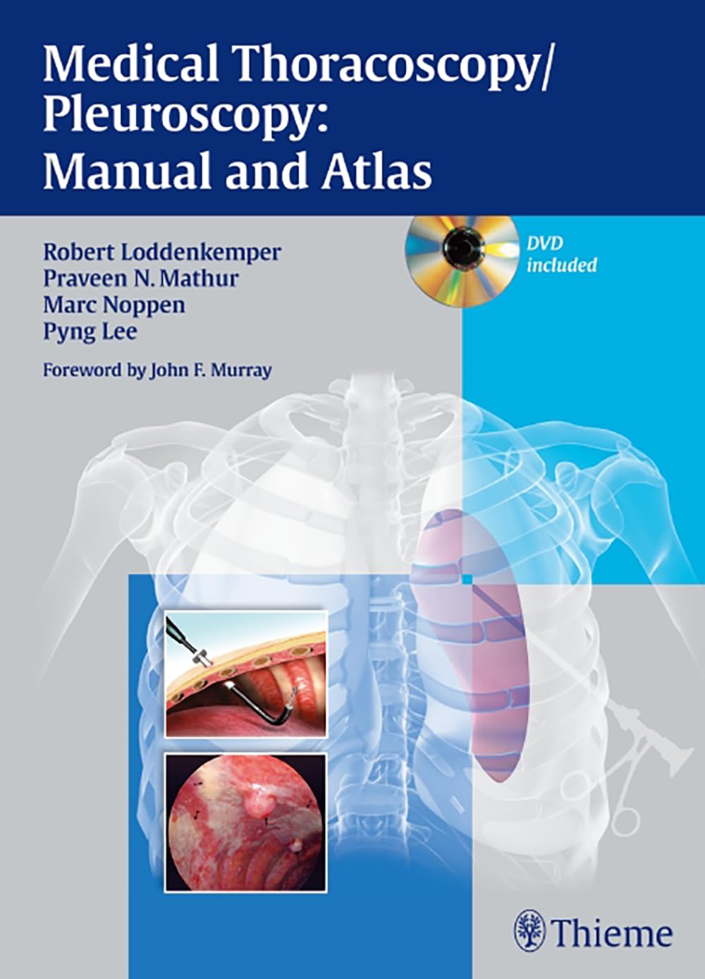 Medical Thoracoscopy / Pleuroscopy: Manual and Atlas: Manual and Atlas. Forew.: Murray, John F. Medicine
