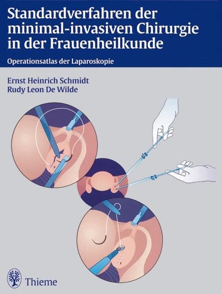 Standardverfahren der minimal-invasiven Chirurgie in der Frauenheilkunde: Operationsatlas der Laparoskopie Medicine