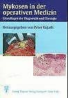 Mykosen in der operativen Medizin Medicine