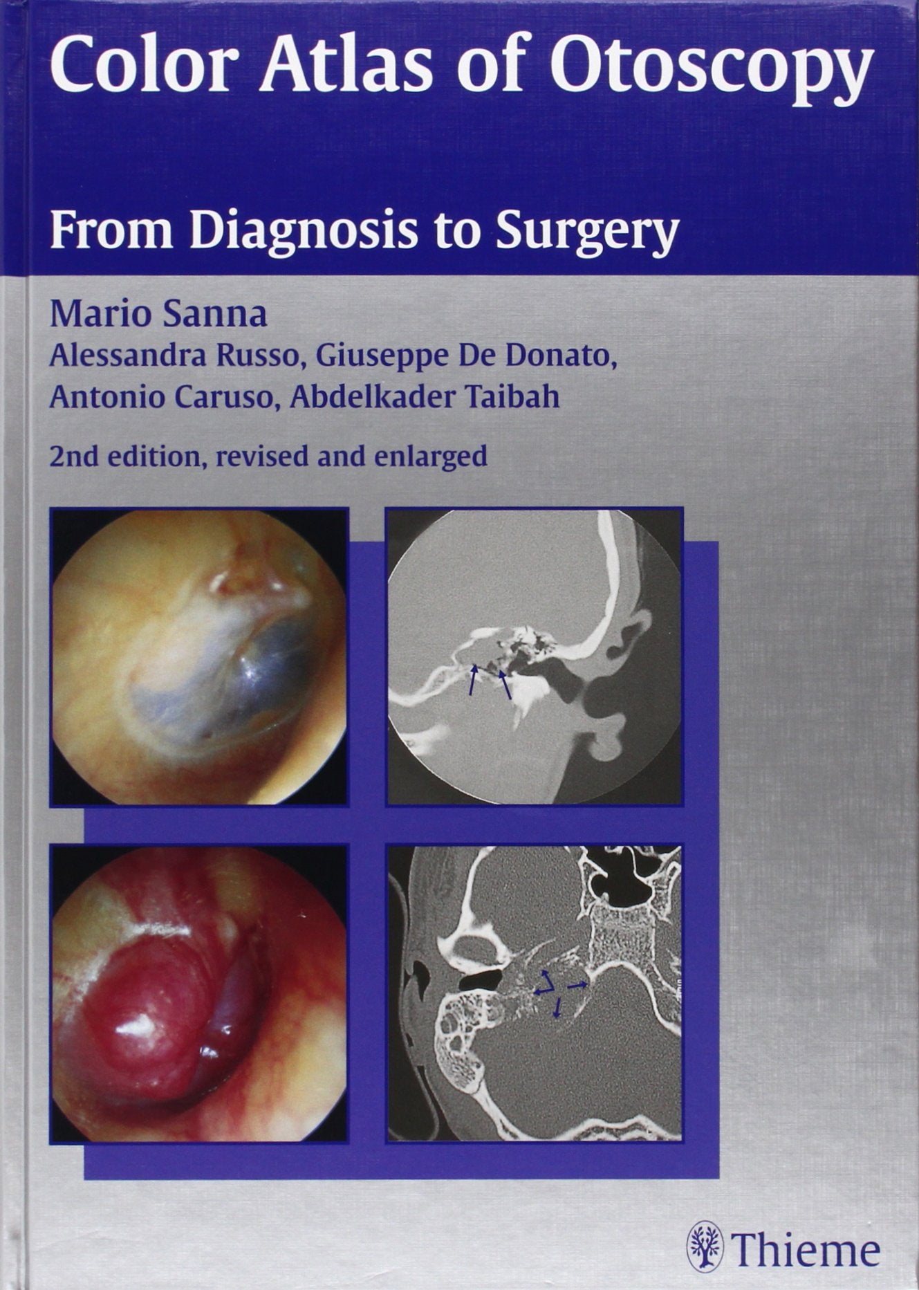 Color Atlas of Otoscopy: From Diagnosis to Surgery Medicine
