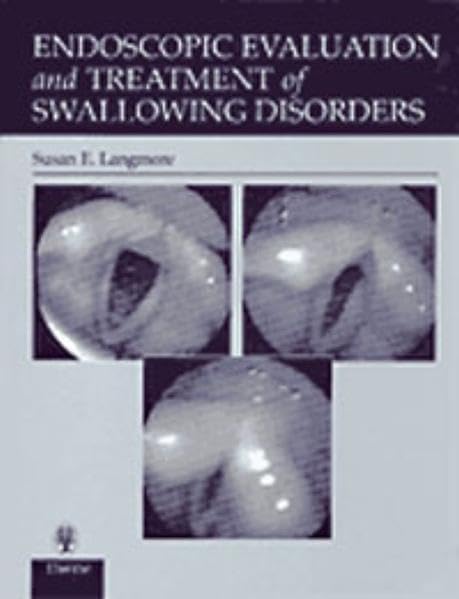 Endoscopic Evaluation and Treatment of Swallowing Disorders Medicine