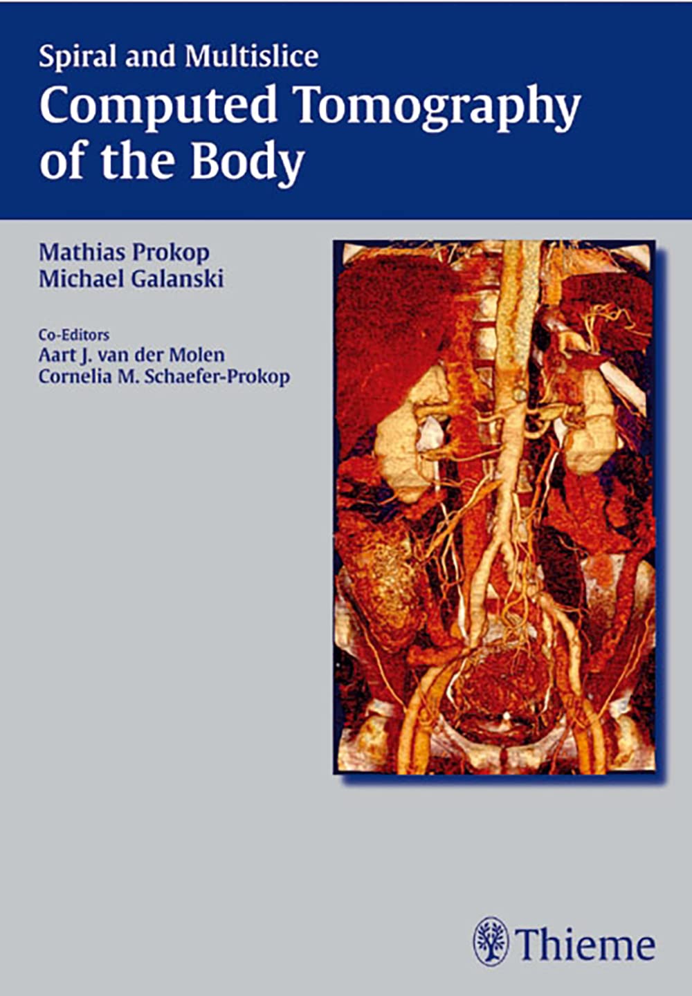 Spiral and Multislice Computed Tomography of the Body Medicine