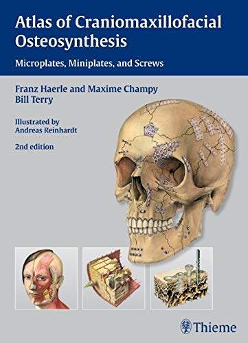 Atlas of Craniomaxillofacial Osteosynthesis: Microplates, Miniplates,and Screws Medicine
