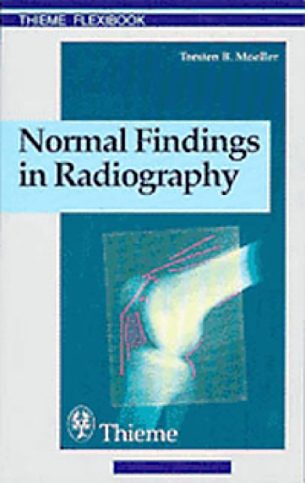 Normal Findings in Radiography: . Zus.-Arb.: Torsten B. Möller Translated by Terry Telger 190 Illustrations (Thieme Flexibook) Medicine