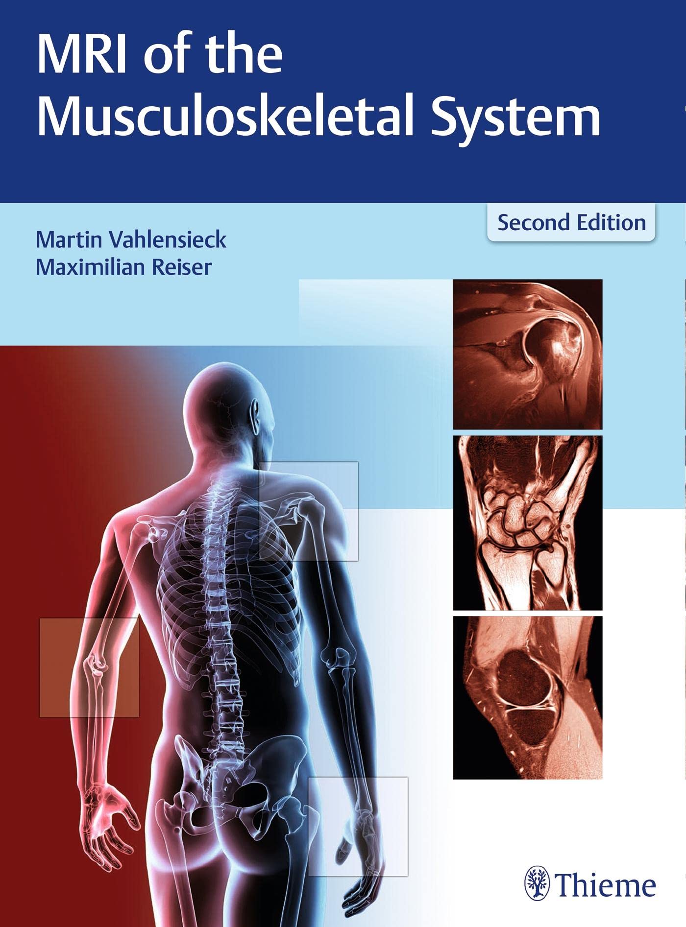 MRI of the Musculoskeletal System Medicine