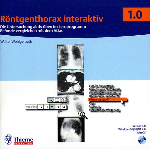 Röntgenthorax interaktiv (CD-ROM): Die Untersuchung aktiv üben mit dem Lernprogramm Befunde vergleichen im Atlas Learning