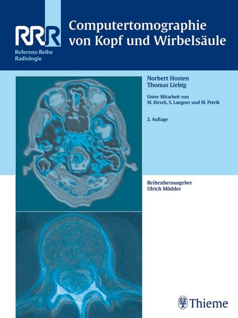 Computertomographie von Kopf und Wirbelsäule: . Zus.-Arb.: Norbert Hosten, Thomas Liebig Geleitwort von Roland Felix 420 teils farbige Abbildungen in ... ... (Referenz-Reihe Radiologie) Medicine