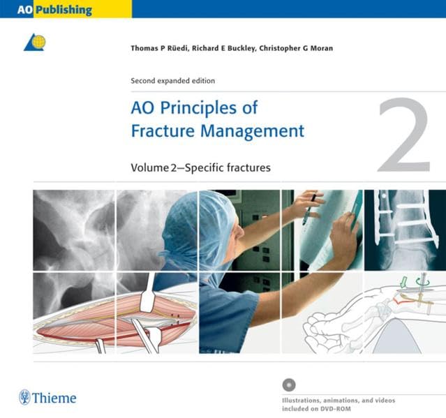 AO Principles of Fracture Management: Vol. 1: Principles, Vol. 2: Specific fractures: Principles; Specific Fractures Medicine