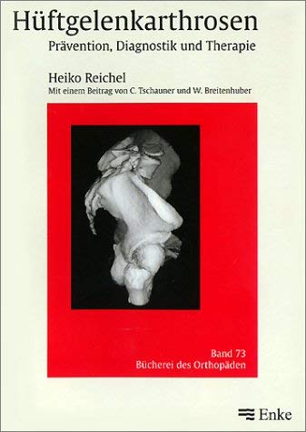 Hüftgelenkarthrosen Medicine