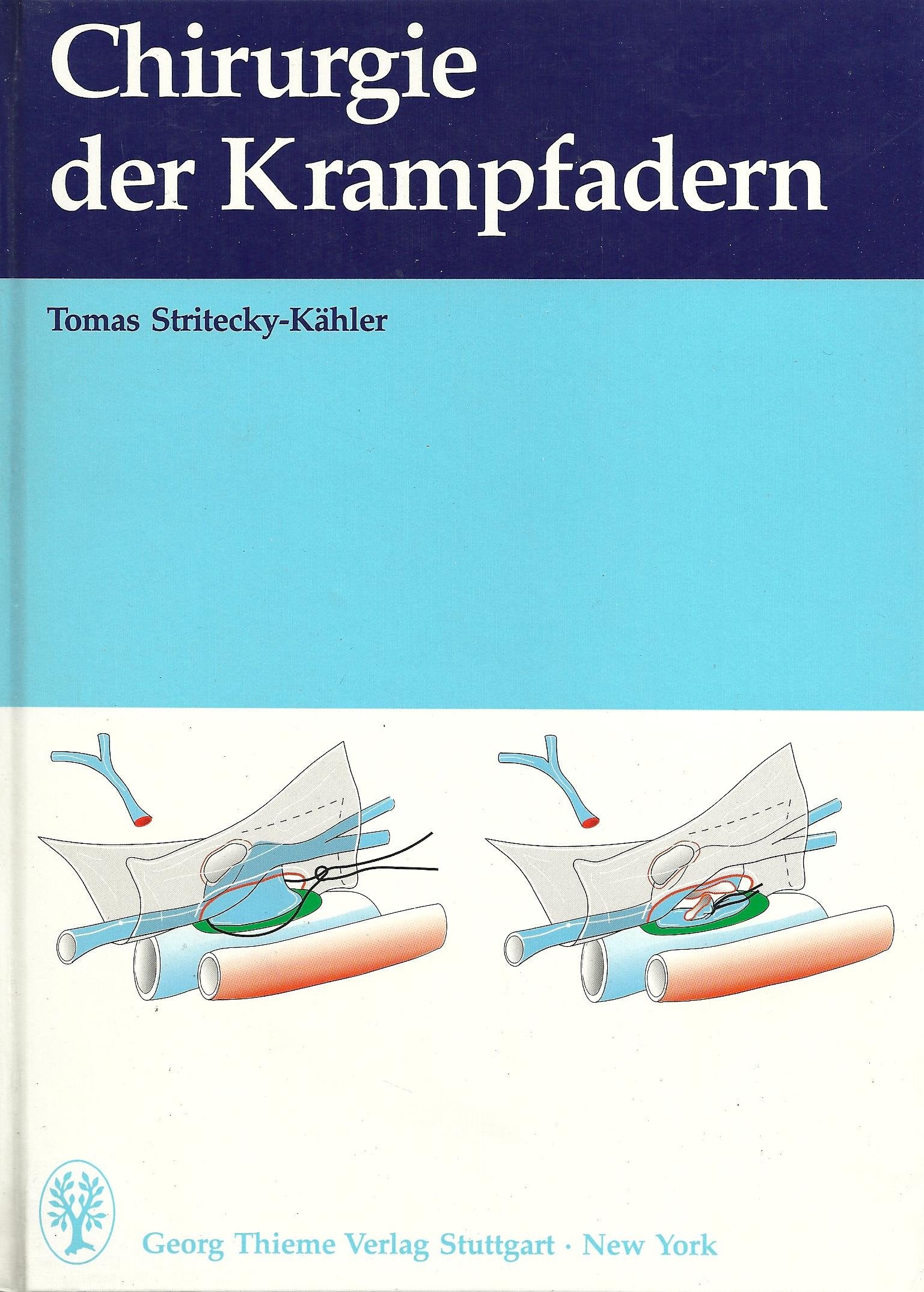 Chirurgie der Krampfadern Medicine