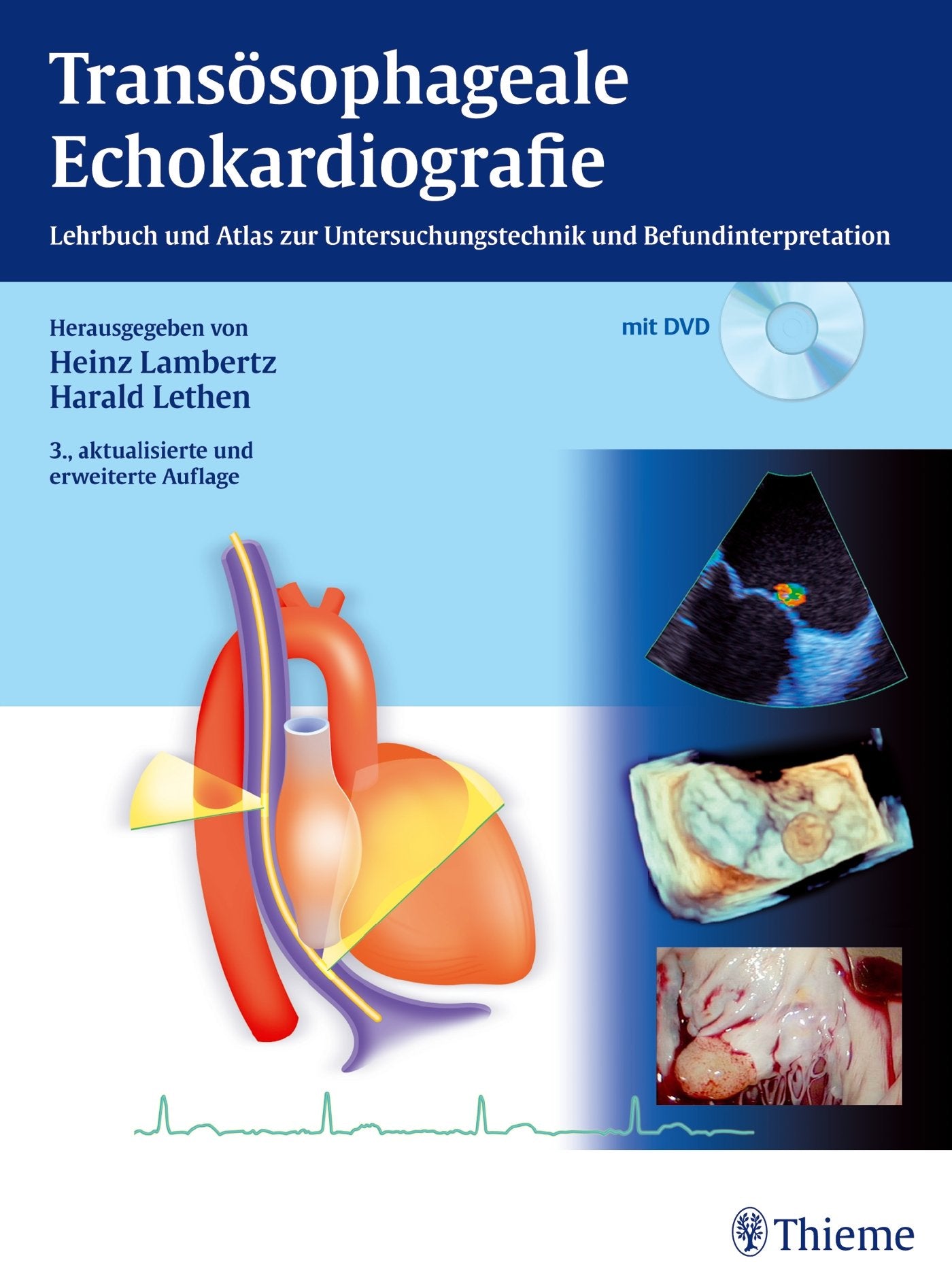 Transösophageale Echokardiografie Medicine
