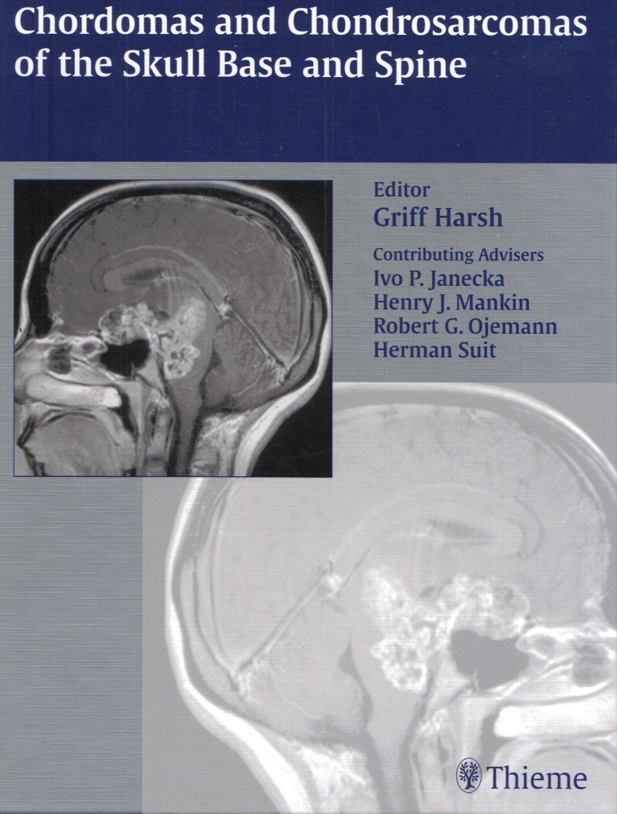 Chordomas and Chondrosarcomas of the Skull Base and Spine Medicine
