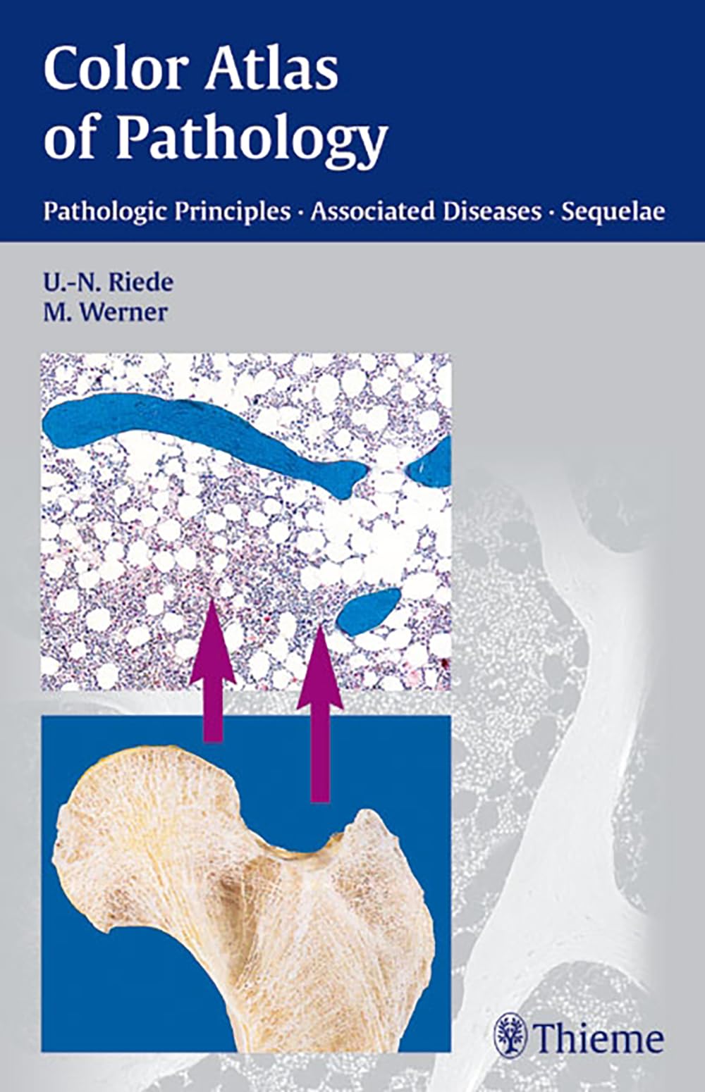 Color Atlas of Pathology: Pathologic Principles, Associated Diseases, Sequela Medicine