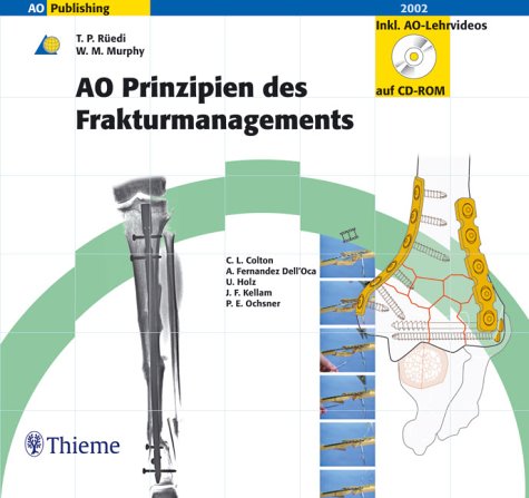 AO Prinzipien des Frakturmanagements (Buch und CD-ROMs) Medicine