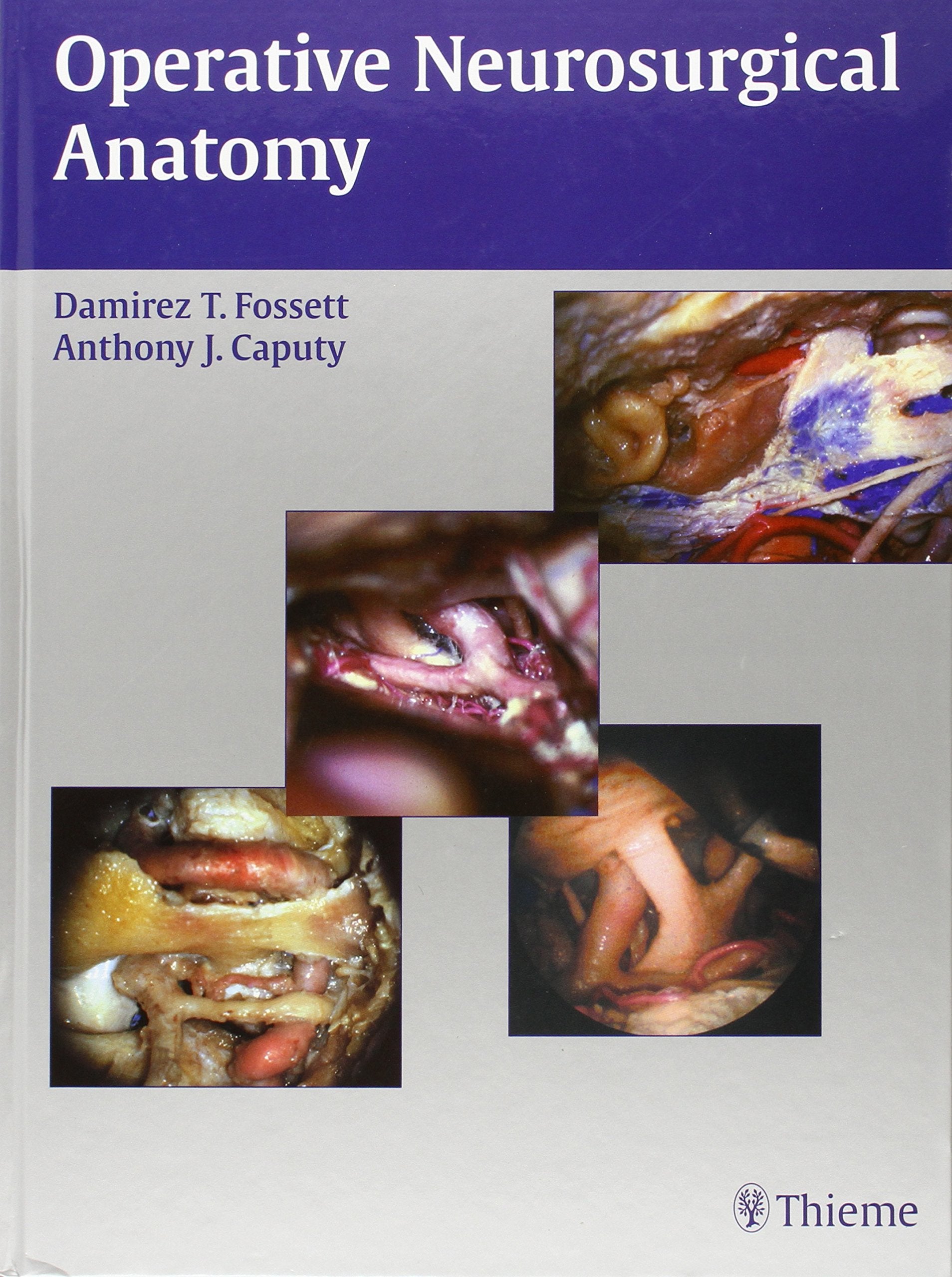 Operative Neurosurgical Anatomy Medicine