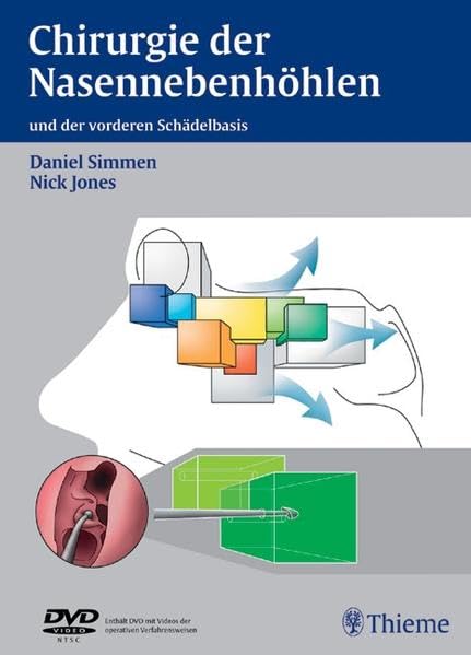 Chirurgie der Nasennebenhöhlen. Mit CD-ROM book