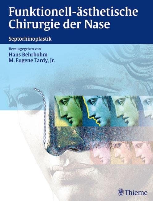 Funktionell-ästhetische Chirurgie der Nase: Septorhinoplastik Medicine