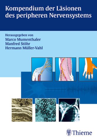 Kompendium der Läsionen des peripheren Nervensystems Medicine Books
