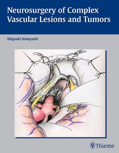 Neurosurgery of Complex Vascular Lesions and Tumors Medicine