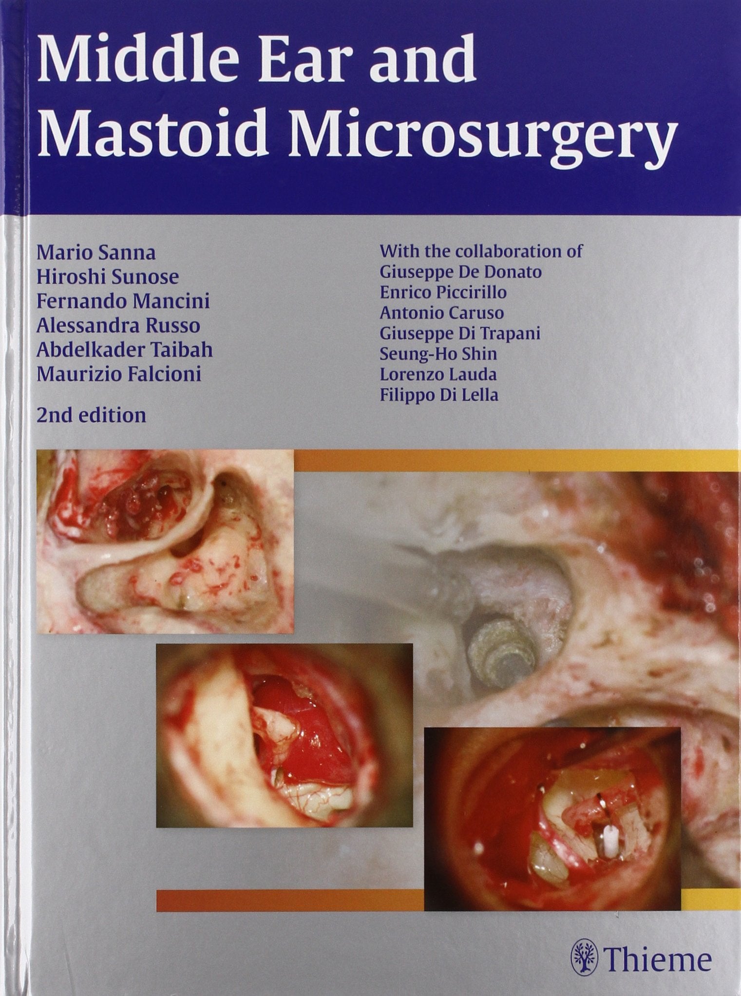 Middle Ear and Mastoid Microsurgery: Hrsg. v. d. Dtsch. Röntgengesellschaft Medicine