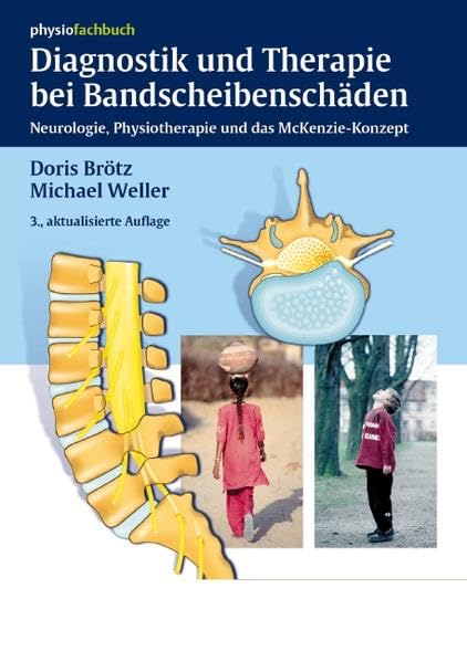 Diagnostik und Therapie bei Bandscheibenschäden Medicine