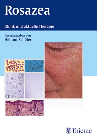 Rosazea: Klinik und aktuelle Therapie Medicine