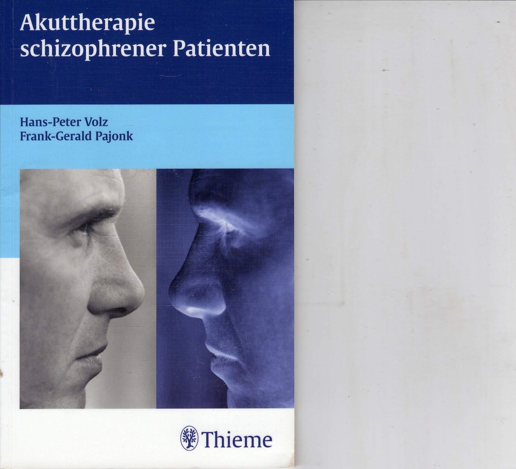 Akuttherapie schizophrener Patienten Medicine