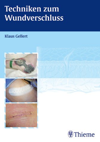 Techniken zum Wundverschluss. Grundlagen und Praxis Medicine