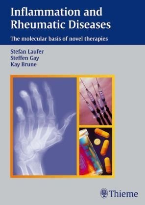 Inflammation and Rheumatic Diseases: The Molecular Basis of Novel Therapies Medicine