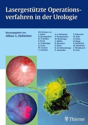 Lasergestütze Operationsverfahren in der Urologie Medicine