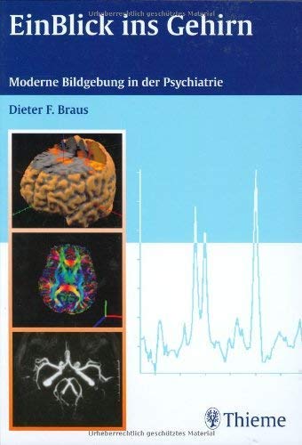 EinBlick ins Gehirn: Moderne Bildgebung in der Psychiatrie Medicine