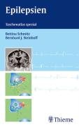 Epilepsien: Taschenatlas spezial Professional & Reference Books