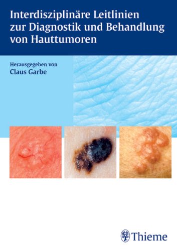Interdisziplinäre Leitlinien zur Diagnostik und Behandlung von Hauttumoren Medicine